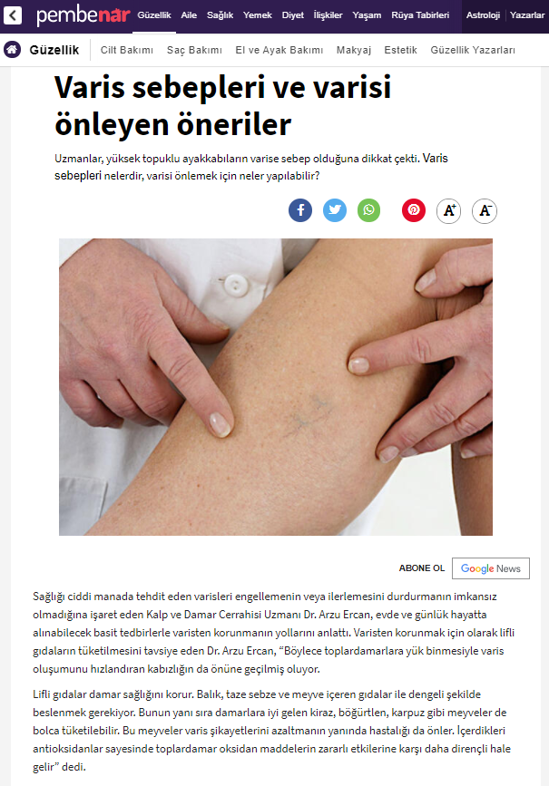 Causes of varicose veins and tips to prevent them