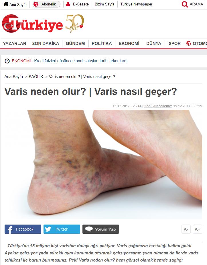 What causes varicose veins? How do they go away?